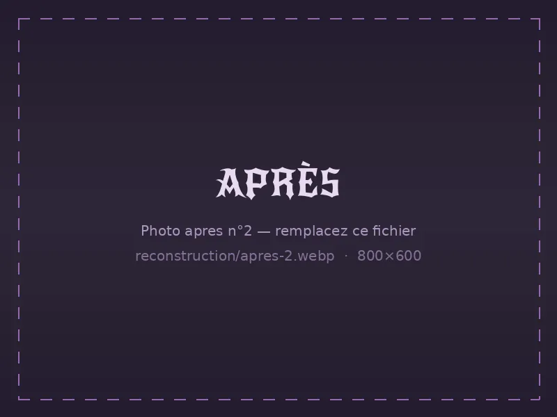Ongles reconstruits et renforcés après soin — exemple 2